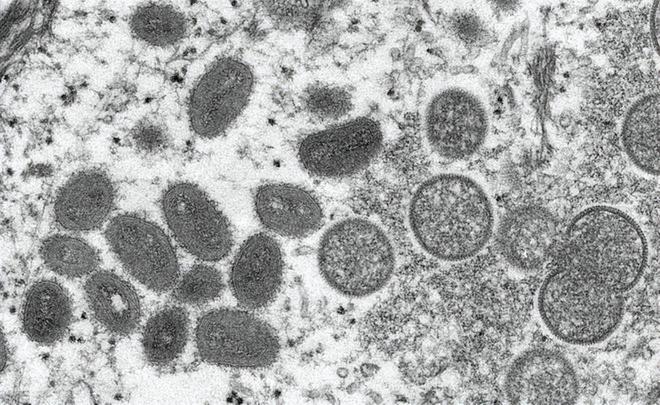 天博继新冠疫情之后猴痘疫情再次在多国爆发这个病毒严重吗？(图3)