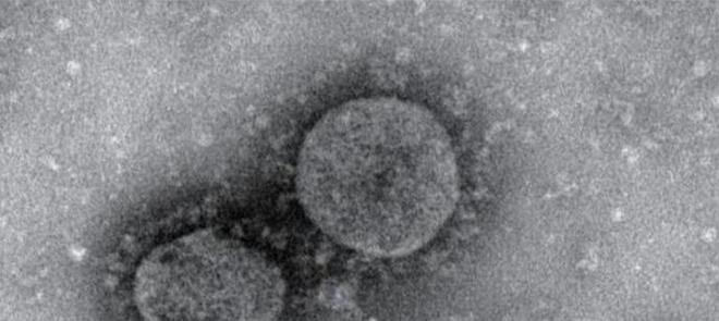 天博人类唯一战胜的病毒天花病毒最终是如何被打败的？(图3)