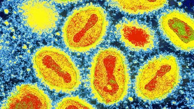 天博美国实验室惊现“天花病毒”致死率远超新冠引爆国际社会(图3)