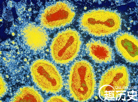 天博官方网站世界上最致命的病毒和细菌：天花病毒(图2)