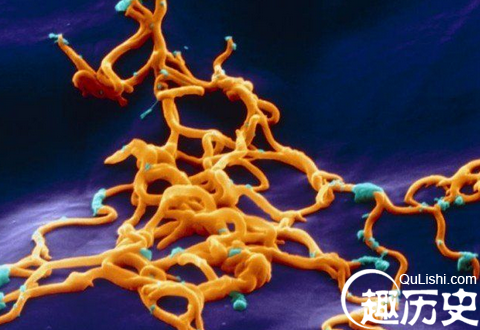 天博官方网站世界上最致命的病毒和细菌：天花病毒(图9)