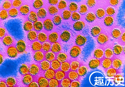 天博官方网站世界上最致命的病毒和细菌：天花病毒(图10)