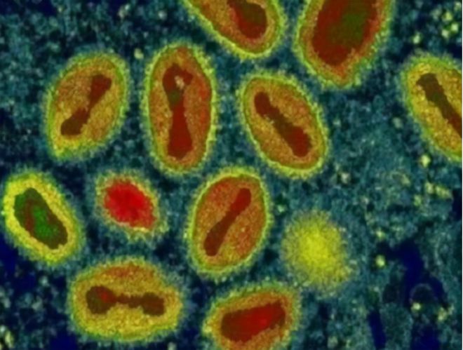 天博美国意外发现天花病毒会对人类造成危害吗？天花有多厉害？(图3)