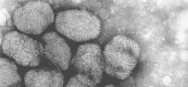 天博官方网站肆虐人间数千年的天花 是人类唯一消灭的传染病(图2)
